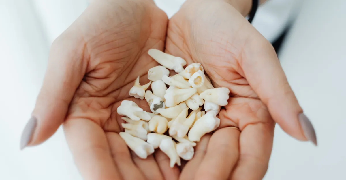 Close-up of hands gently holding a collection of human teeth, symbolizing dental health and care.